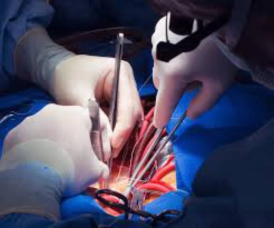 Cardiology and Cardiac Surgery