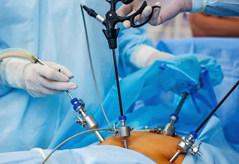 General & Laparoscopic Surgery