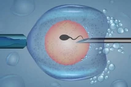IVF and Infertility