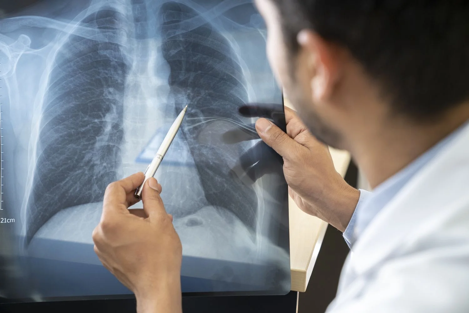 Pulmonology