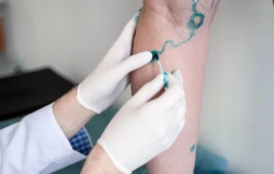 Vascular Surgery